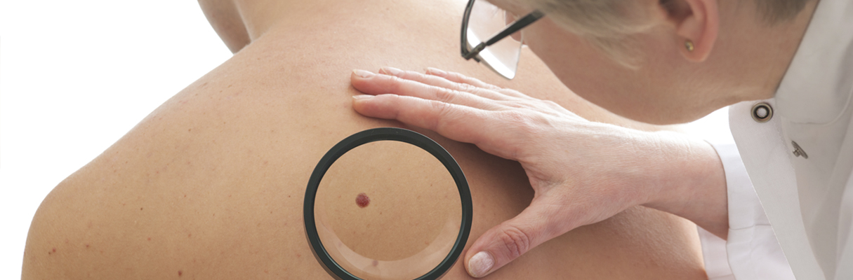 mole diagnosis auckland plastic surgical centre