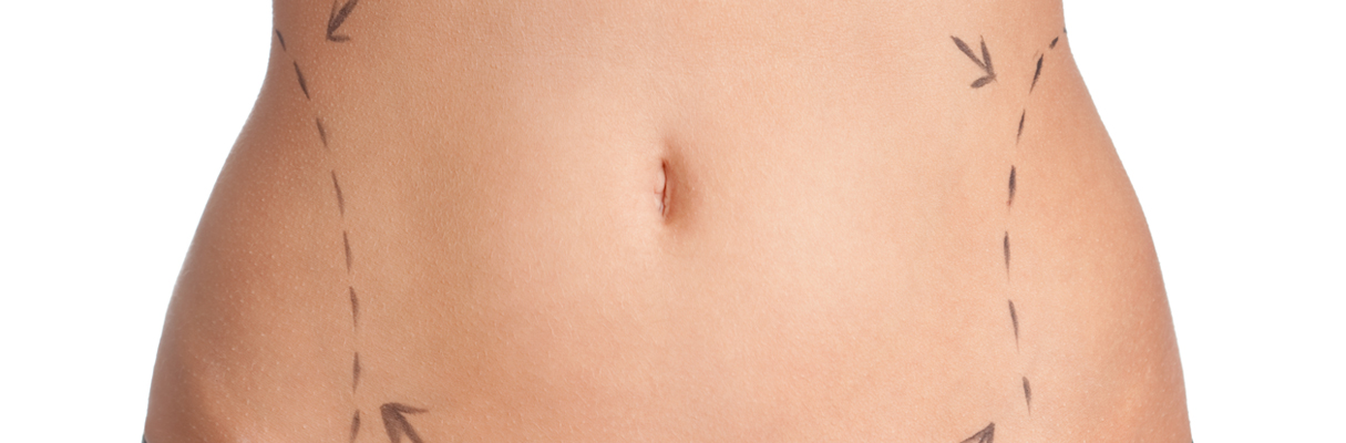 stomach lift auckland plastic surgical centre