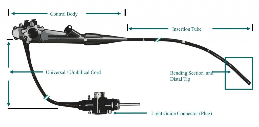 endoscope