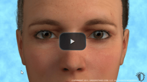eye procedure video image link