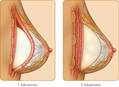 breast diagram